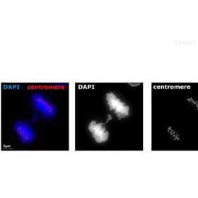 15-234Anti-Centromere Protein Antibody