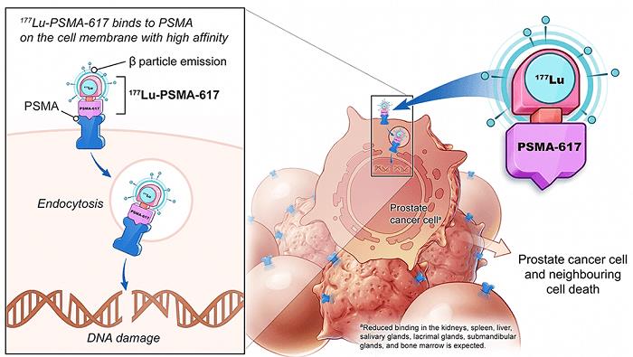 1000_VISION_Targeted_radioligand_therapy