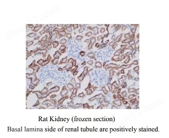 Anti Rat Organic Anion Transporter 3 (OAT3) Polyclonal Antibody