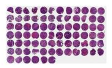 Bladder Tissue Microarray (TMA) Dot: 105 Case: 59 per slide