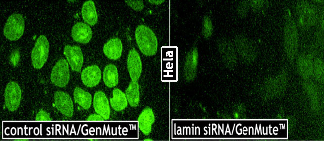 GenMute™ siRNA Transfection Reagent