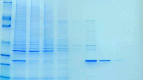 HOOK™ 6X His Protein Purification (Bacteria)