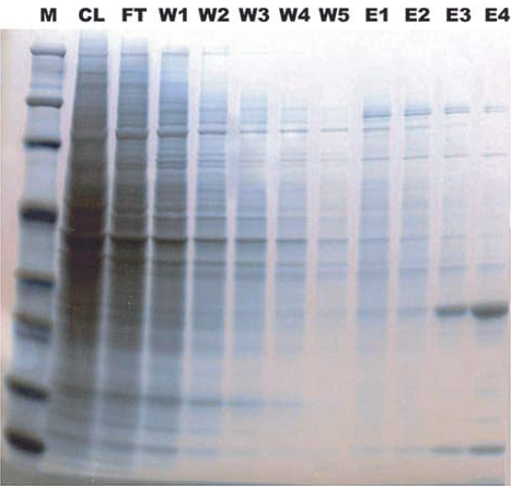 FOCUS™ Glycoprotein（FOCUS糖蛋白试剂盒）