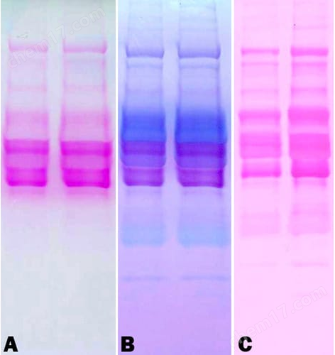 Glycoprotein Staining Kit (糖蛋白染色试剂盒)